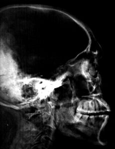 Röntgenaufnahme von Sethos I